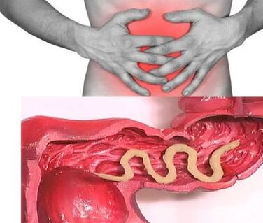 Menselijke parasieten