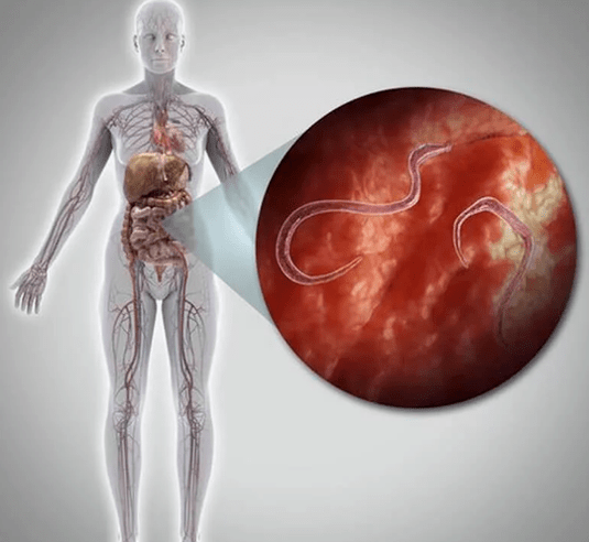 Parasieten in het menselijk lichaam