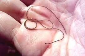 Parasiet in de palm van je hand