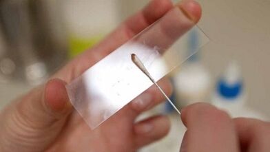 Calais -analyse om parasieten te identificeren