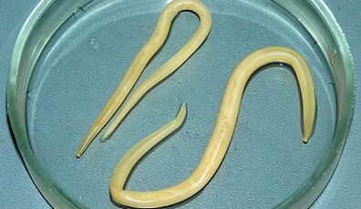 Hoe u tests voor ascariasis correct kunt doen