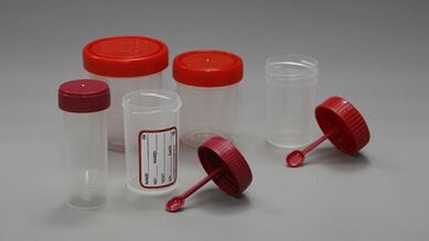 Hoe u zich voorbereidt op de test van parasieten