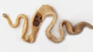 Hoe de aanwezigheid van parasieten in het lichaam te ontdekken