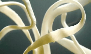 Hoe parasieten uit het menselijk lichaam te verwijderen